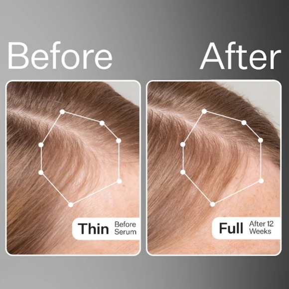 🆕️Act + Acre Cold Pressed Stem Serum Scalp Serum Mini 4 Week Supply - Picture 2 of 9